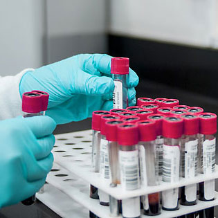 diagnostic in vitro