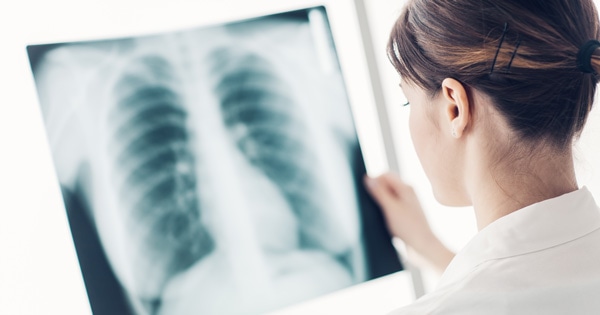 Quand le secteur de la radiologie se financiarise à vitesse grand V